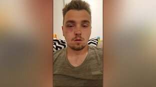 Nick (21) door groep jongens mishandeld na avondje uit