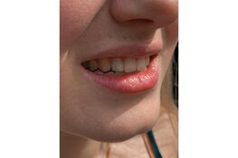 Nieuw bij Kingdom Tattoo & Piercing Alkmaar: Toothgems